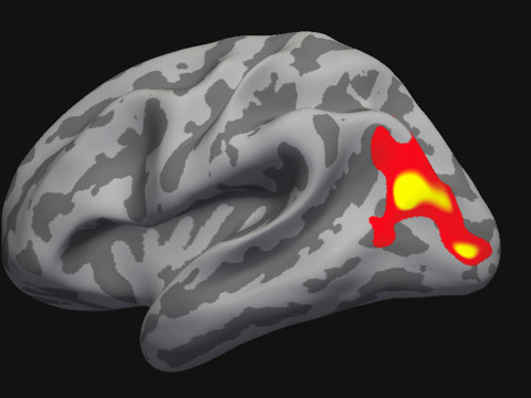 Zurich: la psychothérapie modifie le cerveau