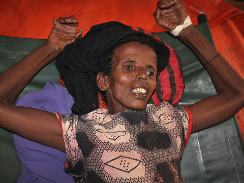 Choléra/diarrhée: plus de 500 morts depuis janvier en Somalie