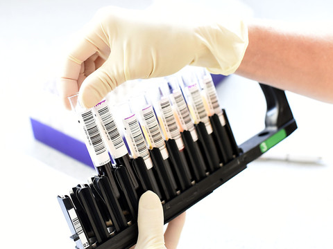 Une percée dans la recherche pour produire du sang en laboratoire