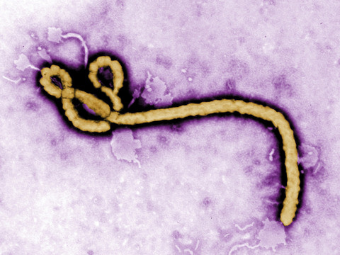 Un anticorps neutralise les souches principales d'Ebola