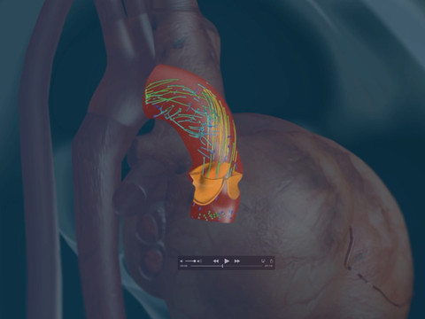 EPFL: une simulation virtuelle du coeur pour un meilleur diagnostic