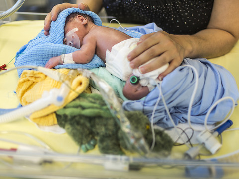 Un tiers des septicémies chez l'enfant contractées à l'hôpital