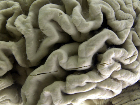 Un jeu vidéo en réalité virtuelle pour dépister Alzheimer