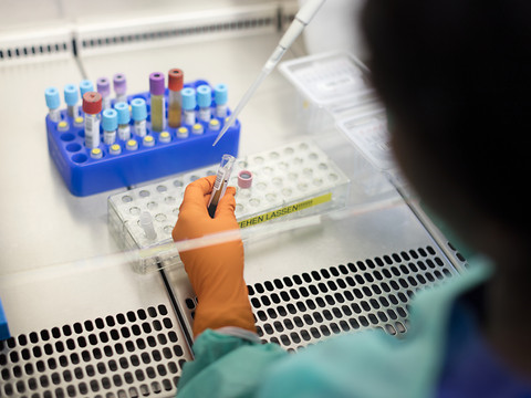 Création d'un triple antiviral efficace contre le virus du sida