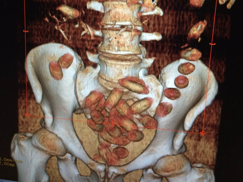 Les douaniers saisissent 1300 kg de drogue en 3 mois