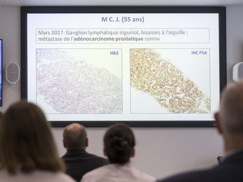 Unir les compétences pour mieux lutter contre les cancers