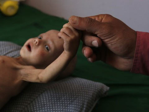 Yémen: onze millions d'enfants ont désespérément besoin d'aide (ONU)