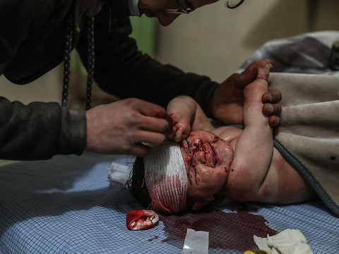 Au moins 17 civils tués dans des attaques sur la Ghouta orientale