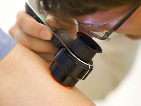 Un ordinateur meilleur que les dermatologues face aux cancers
