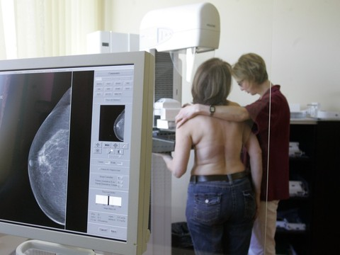 Cancers: l'aube d'une nouvelle ère sans chimiothérapie