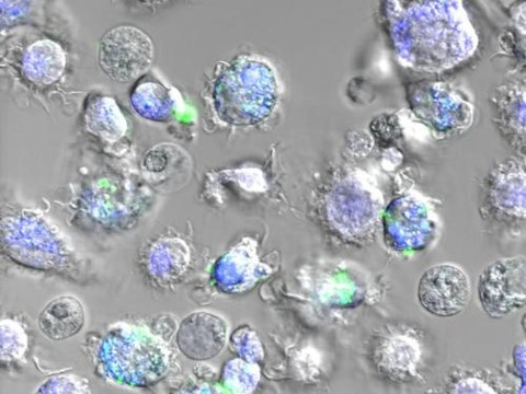 UNIGE: des vaccins incorporés dans une particule de soie d'araignée