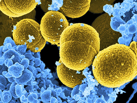 Percée dans la lutte contre le staphylocoque doré multirésistant