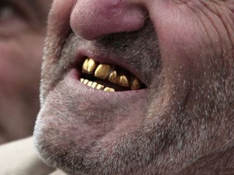 Un homme se fait arracher ses dents en or en pleine rue près de Paris