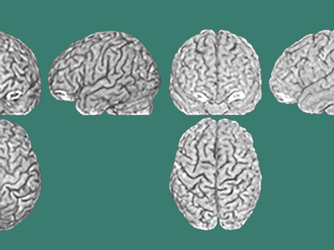 Zurich: chaque cerveau humain est hautement individuel