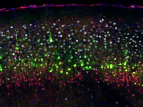 UNIGE: le courant électrique à l'origine de la diversité neuronale