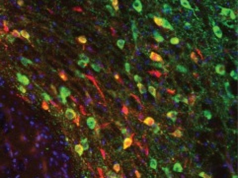 Des synapses du système de la récompense impliquées dans l'autisme