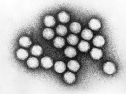 La pneumonie pourrait tuer 11 millions d'enfants d'ici 2030 (étude)