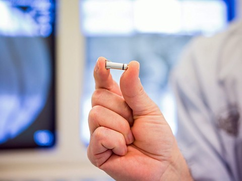 Une enquête dénonce les lacunes du contrôle des implants médicaux