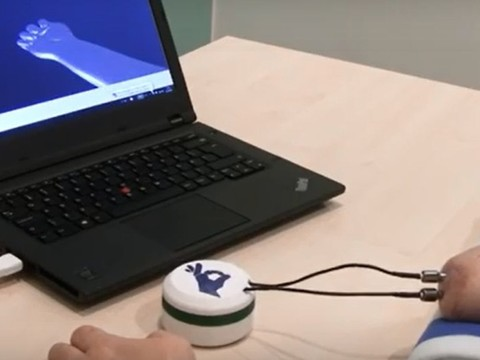 CSEM: une main artificielle sensible et fonctionnelle