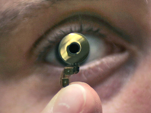 Vers un contrôle accru des implants et des prothèses