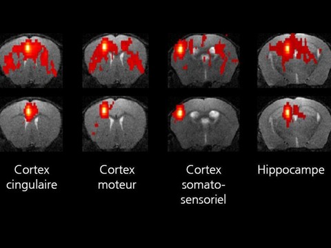Un gène pour mieux comprendre l’autisme et la schizophrénie