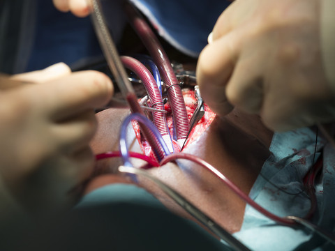 Une multipilule réduirait le risque d'accidents cardiovasculaires