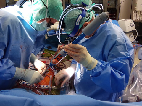 Prothèse remplaçant d'urgence l'aorte d'un enfant à Zurich