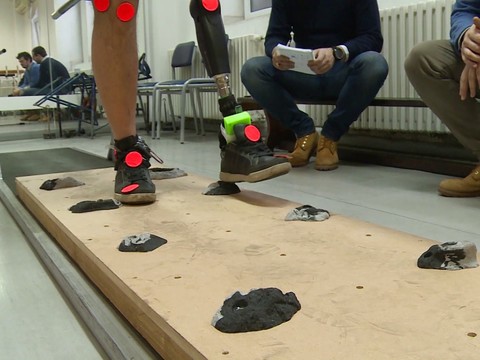 Des patients amputés font corps avec leur jambe bionique