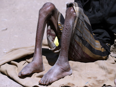 Yémen: les rebelles renoncent à une taxe menaçant l'aide humanitaire