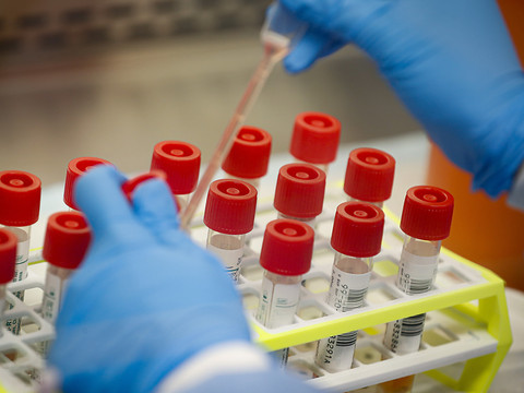Le Covid-19 pourrait devenir saisonnier, prévient un expert