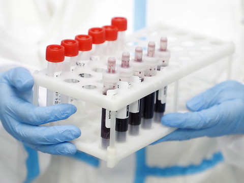 La Suisse compte seulement neuf nouveaux cas de coronavirus
