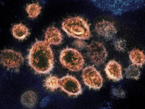 Un institut veut inoculer le SARS-CoV-2 pour tester les vaccins