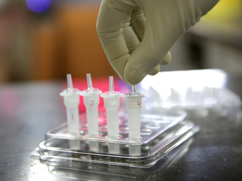 Ruée mondiale sur les tests rapides pour lutter contre le Covid-19