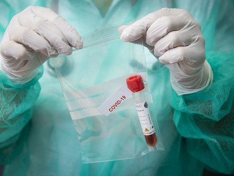 La Suisse recense 411 nouveaux cas de Covid-19 en 24 heures