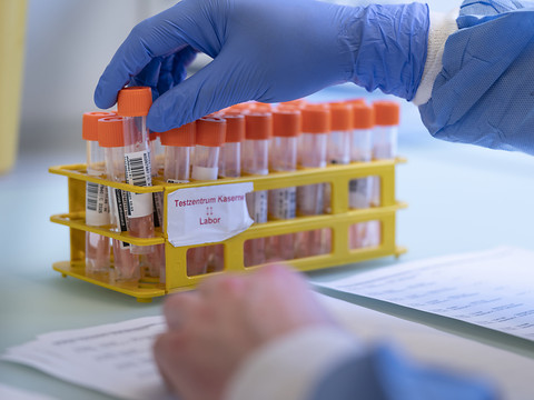 La Suisse compte 1584 nouveaux cas de coronavirus en 24 heures