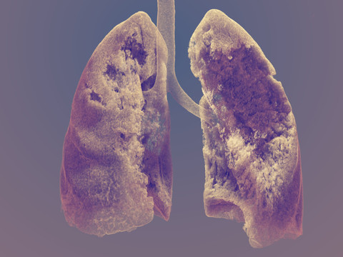 Concours FNS d'images scientifiques: lauréats primés