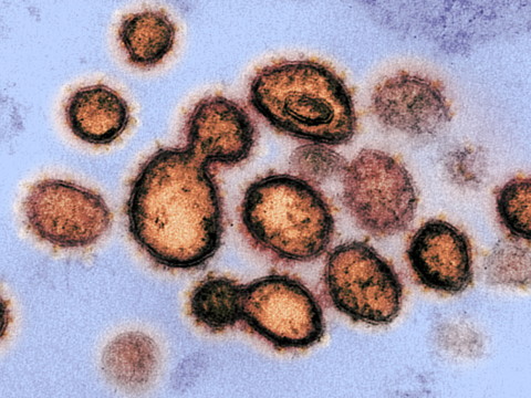 Le variant indien semble résister aux vaccins, selon l'OMS