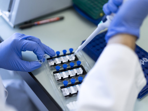 La Suisse compte 2770 nouveaux cas de coronavirus en 96 heures