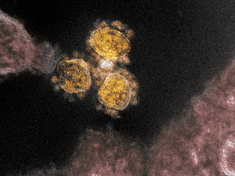 Le SARS-CoV-2 présent aux Etats-Unis dès décembre 2019 (étude)