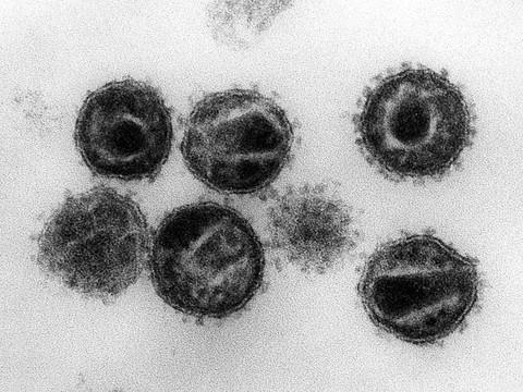 Recul inédit de la lutte contre sida, tuberculose et paludisme