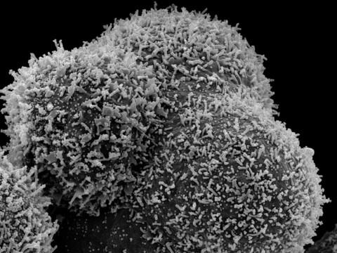 CHUV et EPFL: découverte d'un nouvel anticorps neutralisant très puissant contre les variants du Covid-19