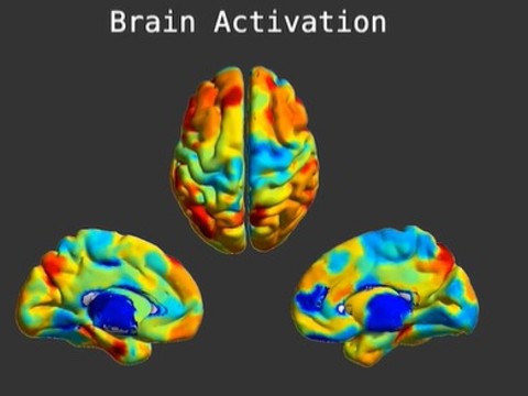 EPFL: chaque cerveau possède sa propre empreinte