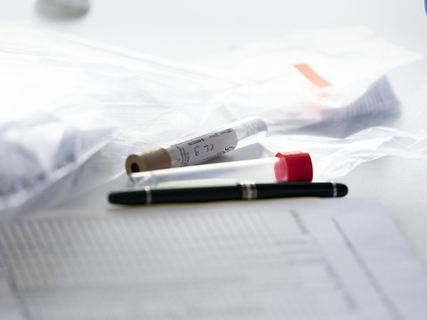 La Suisse compte 3886 nouveaux cas de coronavirus en 24 heures