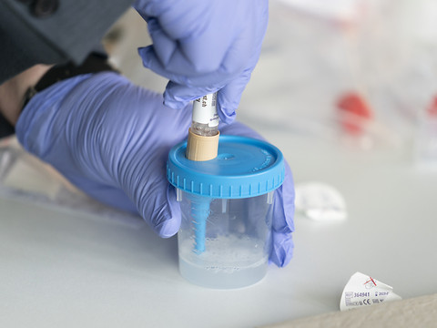 La Suisse compte 11'562 nouveaux cas de coronavirus en 24 heures