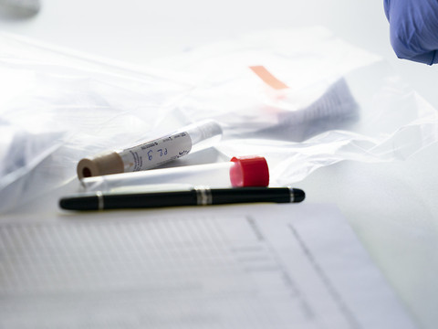 La Suisse compte 67'906 nouveaux cas de coronavirus en 72 heures