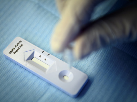 La Suisse compte 33'386 nouveaux cas de coronavirus en 24 heures