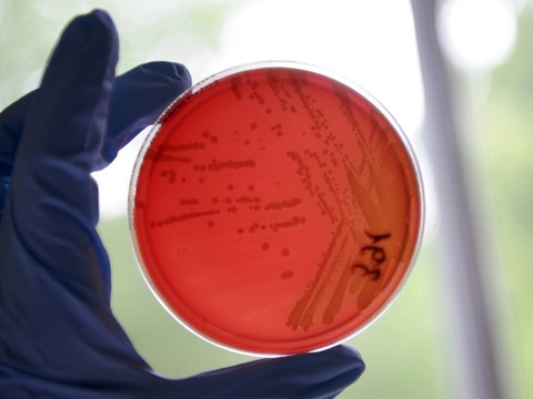 Novartis: la filiale Sandoz étend sa collaboration avec Ares