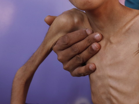 L'insécurité alimentaire a touché 193 millions de personnes en 2021