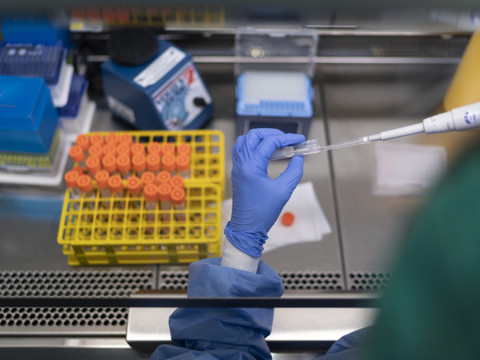 Les cantons ne veulent pas prendre en charge les coûts des tests