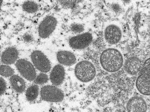 Variole du singe: l'OFSP étudie la possibilité d'acheter un vaccin